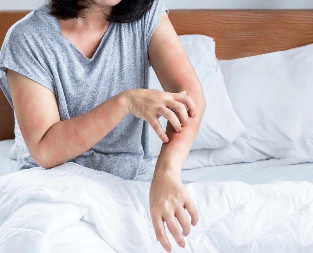 Person sitting on bed scratching red irritated skin on arm, illustrating possible allergic reaction to synthetic fabrics or materials.